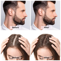 Derma Roller 0.5mm